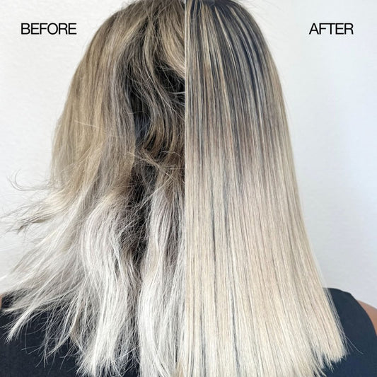 Lasio Follicle Filler Kit for hair treatment, featuring bottles and applicator tools on a white background.